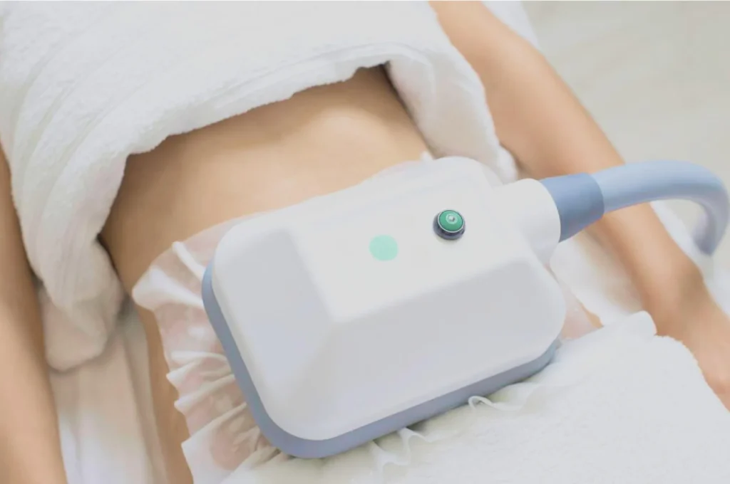 How Fat Freezing and HIFU Work Together? 3 advantages to combining Fat Freezing and HIFU Matlock