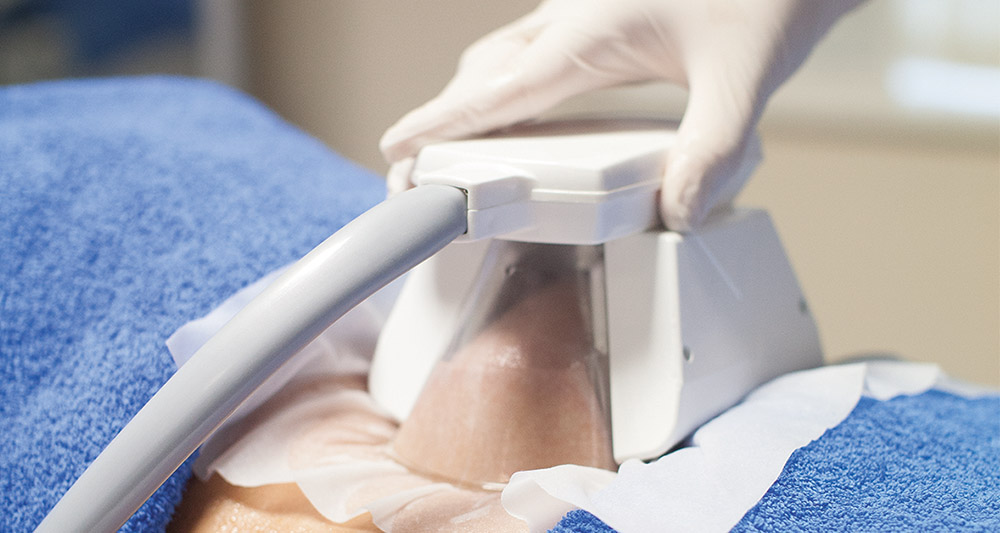 How Fat Freezing and HIFU Work Together? 2 Multiple Areas in One Session HIFU and Fat Freezing Matlock
